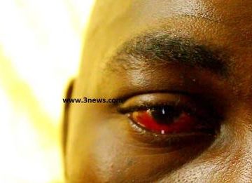 Young man in Wa flogging video on the verge of losing eye