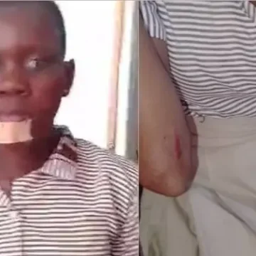 Motorbike Accident Injures Five BECE Candidates in Wassa Attiku