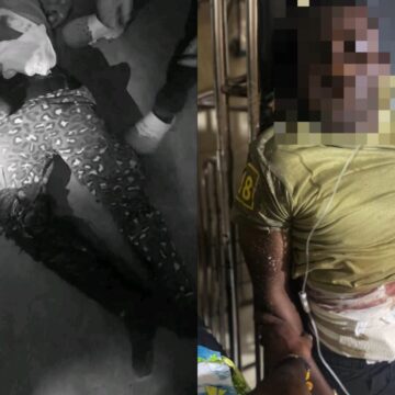 Tempane District Ambush: Two Immigration Officers Shot and Injured