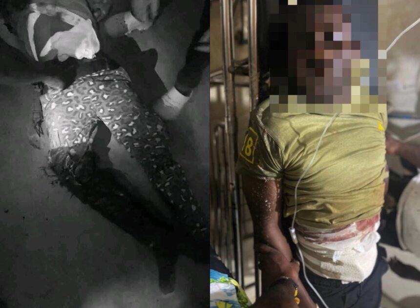Tempane District Ambush: Two Immigration Officers Shot and Injured