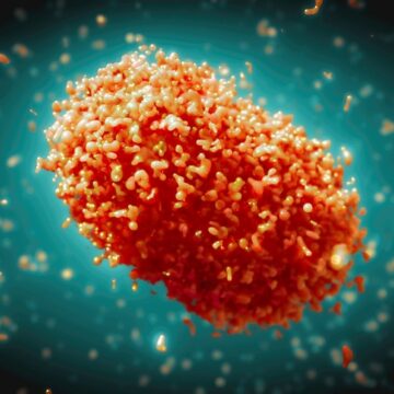 Ghana Records 12 New Mpox Cases, Total Hits 980