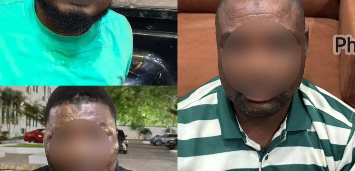 Police Nab Three More In Adabraka Gold  Heist, Total Arrests Now  Seven