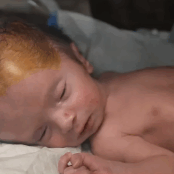 Gaza’s Unseen Casualties: A Surge In Stillbirths And Birth Defects